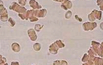Личинка паразита в эритроците